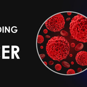 Complete Cancer Protocol-Advanced Comprehensive Cancer Support Plan