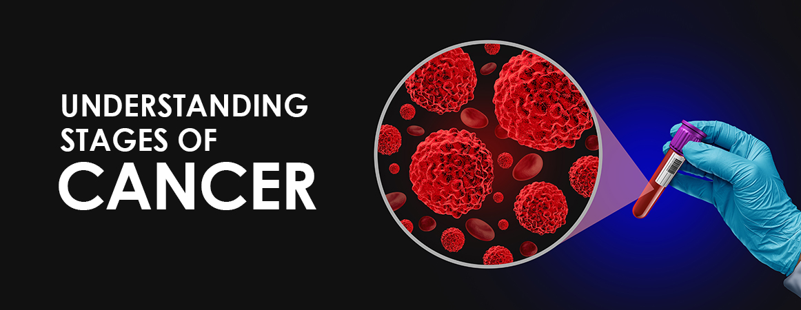 Complete Cancer Protocol-Advanced Comprehensive Cancer Support Plan